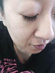 点击看大图 -薇兰专业脱毛连锁机构