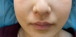 体验后-加减美医美连锁品牌