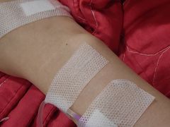 -无锡市第二人民医院(南院)