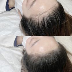 -久匠·纹眉纹绣半永久