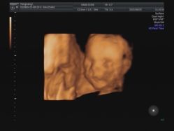 -武汉百佳妇产医院