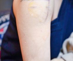 文字-新肤洗纹身