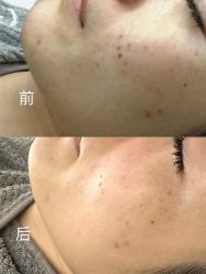 -KONSISTANT科思坦汀问题肌·科技美肤