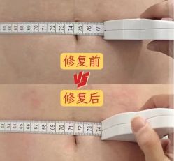-玛丽亚妇产医院产后修复·医美产康中心
