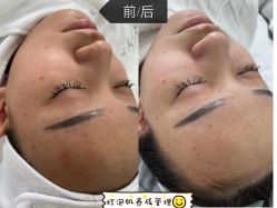 体验前-SKIN79皮肤管理中心
