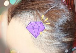 -大麦微针植发全国连锁