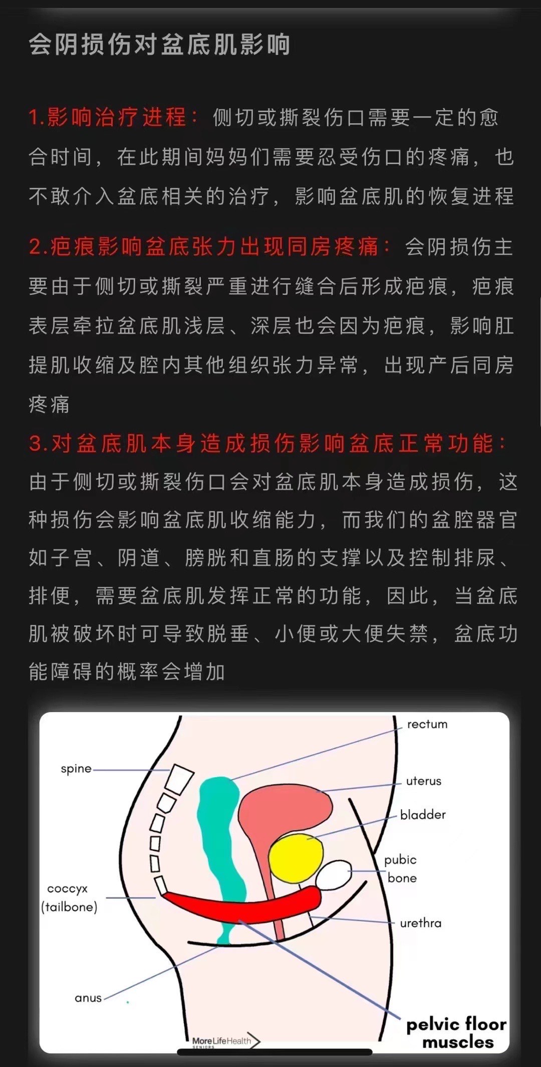 顺产侧切位置图片