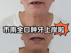 -优诺口腔(华东总院)
