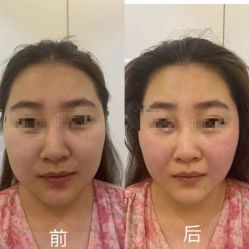 -丰联丽格医疗美容·联合丽格眼整形中心