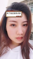 -素美医疗美容·西南眼鼻整形·修复基地