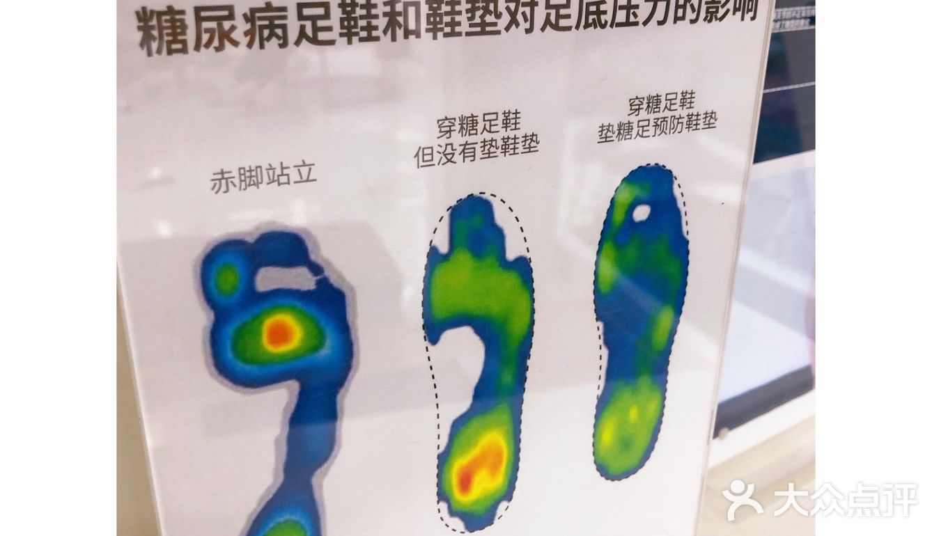 足部矫正找哪家？SENSOPED橙捷足部矫形中心