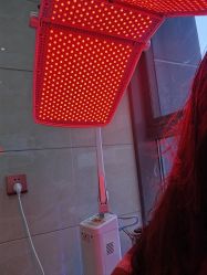 -碧莲盛·不剃发植发