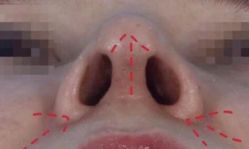 -南宁华美医疗美容医院