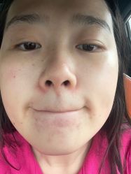 -素美医疗美容·西南眼鼻整形·修复基地