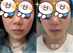 -佛山曙光金子医学美容医院