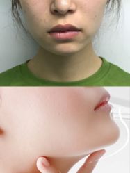 -美莱医学美容医院
