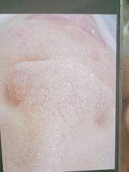 -SKIN79皮肤管理中心
