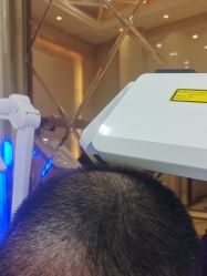 -碧莲盛·不剃发植发