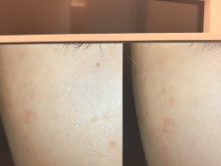 -苑苑vbeauty科技美容SPA