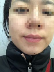 -新美荟医美·专注面部美学抗衰