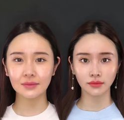 -上海伊莱美医疗美容医院