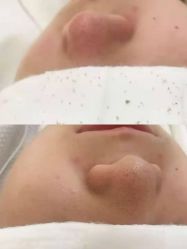 点击看大图 -苑苑vbeauty科技美容SPA