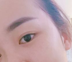 点击看大图 -弘美医美·艾维岚童颜抗衰中心