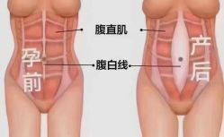 -昕孕瑜伽·孕妇瑜伽·产后修复