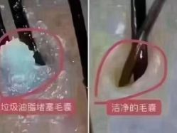 -肤原祛痘修肤中心