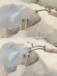 点击看大图 -韩国淼美颜皮肤管理官方直营店