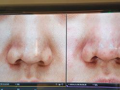 -苑苑vbeauty科技美容SPA
