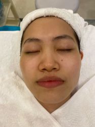-agge蛋白医美