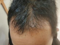 -新生植发·植养护一体