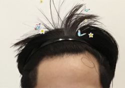 -大麦微针植发全国连锁