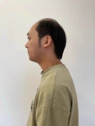 -唐风采假发补发定制