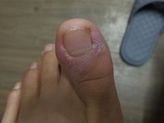 -世龙世家灰指甲·甲沟炎·跖疣护理·修脚(东江湾路店)