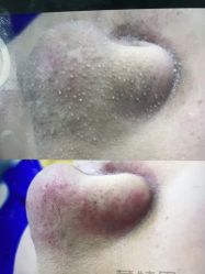 -蕾特恩专业祛痘·皮肤管理