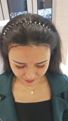 -大麦微针植发丨全国连锁