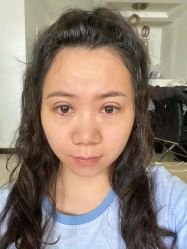 -素美医疗美容·西南眼鼻整形·修复基地