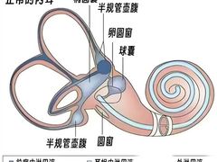 -自然之声助听器(平凉店)