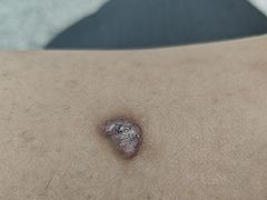 -大连市皮肤病医院