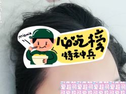 -大麦微针植发全国连锁