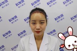 点击看大图 -大麦微针植发丨全国连锁