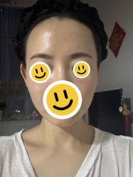 体验后-广州美莱医疗美容医院