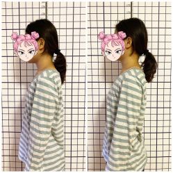 -FACE·日本小颜矫正美容整骨サロン