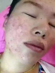 -痘院士祛痘美容皮肤管理