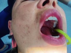 -同步齿科·数字化正畸种植口腔中心(前山店)