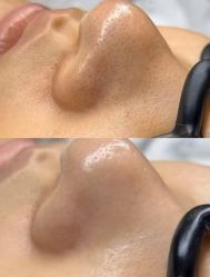 -SKIN79皮肤管理中心