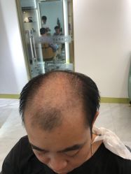 -发饰美男士增发补发假发定制店