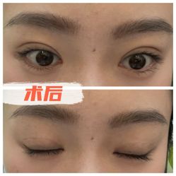 -素美医疗美容·西南眼鼻整形·修复基地